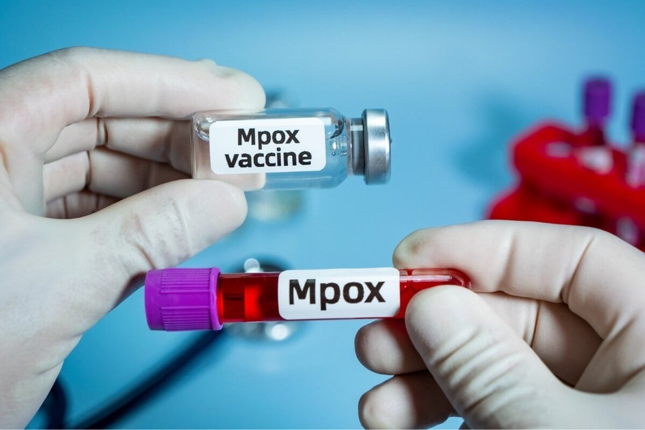 Moçambique confirma 11 novos casos de mpox: total sobe para 49 enquanto país aguarda chegada de vacinas